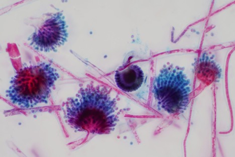 Mycotoxin Exposure from Mold Spores Inhalation